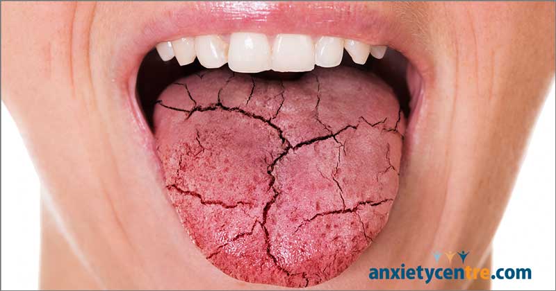 dry mouth (xerostomia) and anxiety