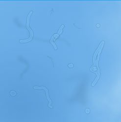 what floaters look like
